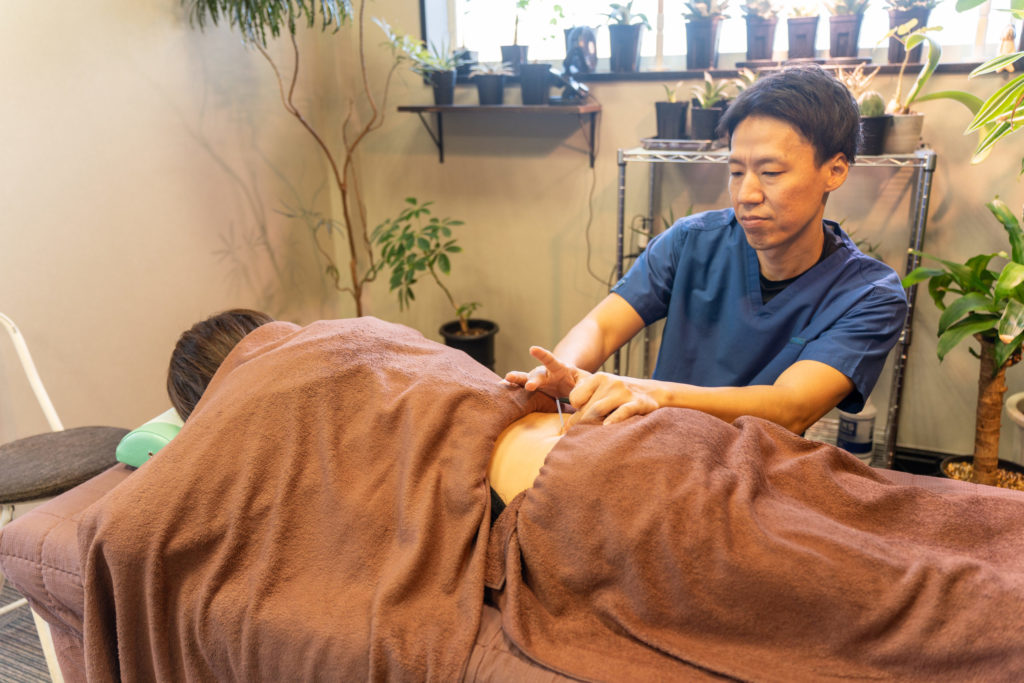 腰への鍼施術風景